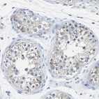 Immunohistochemical staining of human testis shows weak membranous positivity in cells in seminiferous ducts.
