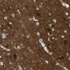 Immunohistochemical staining of human cerebral cortex shows strong cytoplasmic positivity in neuropil.
