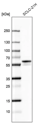 Western blot analysis in human cell line SCLC-21H.