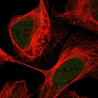 Immunofluorescent staining of human cell line U-2 OS shows localization to nucleoplasm.