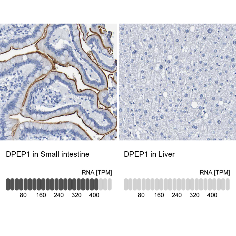 Anti-DPEP1 Antibody
