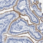 Immunohistochemical staining of human small intestine shows strong positivity in apical membrane in glandular cells.