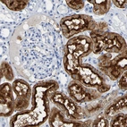 Immunohistochemical staining of human kidney shows strong membranous and cytoplasmic positivity in cells in tubules.