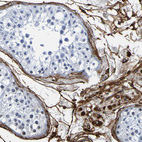 Immunohistochemical staining of human testis shows strong membranous positivity in Leydig cells.