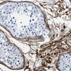 Immunohistochemical staining of human testis shows strong membranous positivity in Leydig cells.