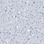 Anti-DPEP1 Antibody