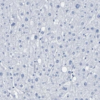 Immunohistochemical staining of human liver shows no positivity in hepatocytes as expected.