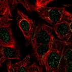 Immunofluorescent staining of human cell line Hep G2 shows localization to nucleus & cell junctions.