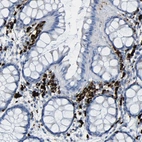 Immunohistochemical staining of human rectum shows strong cytoplasmic positivity in lymphoid cells.