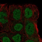 Anti-MGAT4B Antibody