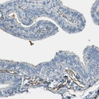 Immunohistochemical staining of human fallopian tube shows moderate membranous positivity in endothelial cells.