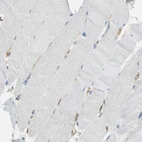 Immunohistochemical staining of human skeletal muscle shows no positivity in striated muscle fibers as expected. Endothelial cells are positive.