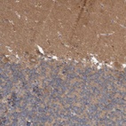 Anti-ANKK1 Antibody
