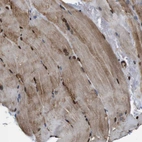 Immunohistochemical staining of human skeletal muscle shows moderate nuclear and cytoplasmic positivity in a subset of myocytes.