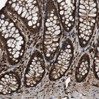 Immunohistochemical staining of human gastrointestinal shows strong nuclear and cytoplasmic positivity in glandular cells.