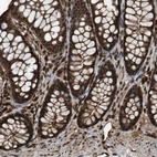 Immunohistochemical staining of human gastrointestinal shows strong nuclear and cytoplasmic positivity in glandular cells.