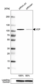 Western blot analysis in A-549 cells transfected with control siRNA, target specific siRNA probe #1, using Anti-VCP antibody. Remaining relative intensity is presented. Loading control: Anti-GAPDH.