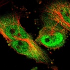 Immunofluorescent staining of human cell line U-251 MG shows localization to nucleoplasm & cytosol.