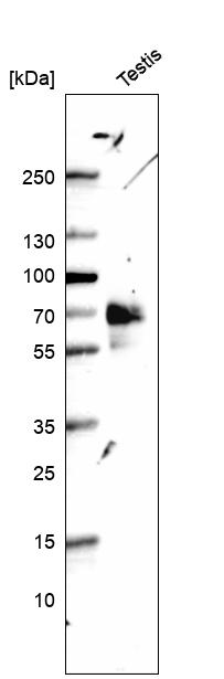 Anti-ILDR2 Antibody