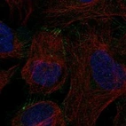 Immunofluorescent staining of human cell line U-2 OS shows localization to plasma membrane.