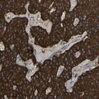 Immunohistochemical staining of human parathyroid gland shows strong cytoplasmic positivity in glandular cells.