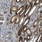 Immunohistochemical staining of human kidney shows moderate to strong cytoplasmic positivity in cells in tubules.
