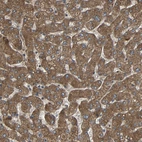 Immunohistochemical staining of human liver shows moderate cytoplasmic positivity in hepatocytes.