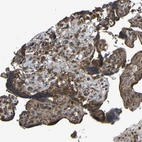 Immunohistochemical staining of human placenta shows moderate cytoplasmic positivity in trophoblastic cells.