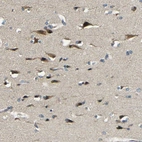 Immunohistochemical staining of human Cerebral cortex shows moderate granular cytoplasmic positivity in neuronal cells.