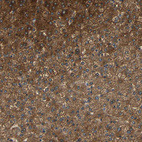 Immunohistochemical staining of human Liver shows strong granular cytoplasmic positivity in hepatocytes.