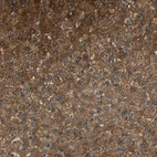 Immunohistochemical staining of human Liver shows strong granular cytoplasmic positivity in hepatocytes.