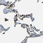 Immunohistochemical staining of human Lung shows strong granular cytoplasmic positivity in macrophages.