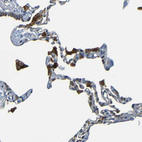 Anti-FNDC3A Antibody