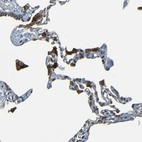 Immunohistochemical staining of human Lung shows strong granular cytoplasmic positivity in macrophages.