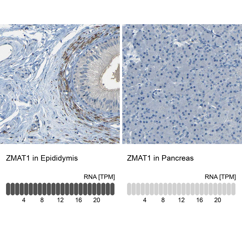 Anti-ZMAT1 Antibody