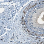 Immunohistochemical staining of human epididymis shows high expression.