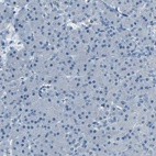 Anti-ZMAT1 Antibody