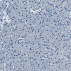 Immunohistochemical staining of human pancreas shows low expression as expected.