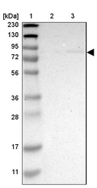 Lane 1: Marker [kDa] 230, 130, 95, 72, 56, 36, 28, 17, 11_br/_Lane 2: Human cell line RT-4_br/_Lane 3: Human cell line U-251MG sp