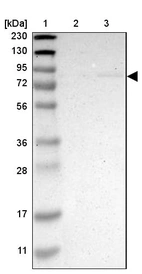 Lane 1: Marker [kDa] 230, 130, 95, 72, 56, 36, 28, 17, 11_br/_Lane 2: Human cell line RT-4_br/_Lane 3: Human cell line U-251MG sp