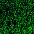 Immunofluorescence staining of mouse facial nucleus shows strong positivity in neuronal cell bodies and processes.