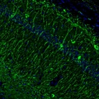 Immunofluorescence staining of mouse hippocampus shows selective immunoreactivity in the CA1 area.