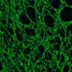 Immunofluorescence staining of mouse globus pallidus shows immunoreactivity in dense network of dendrites.