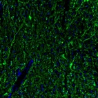 Immunofluorescence staining of mouse lateral septum shows immunoreactivity in neurons and processes.