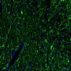 Immunofluorescence staining of mouse lateral septum shows immunoreactivity in neurons and processes.