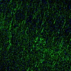 Immunofluorescence staining of mouse cerebral cortex shows immunoreactivity in neurons and dendrites.