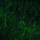 Immunofluorescence staining of mouse cerebral cortex shows immunoreactivity in neurons and dendrites.