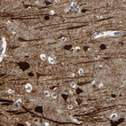 Immunohistochemical staining of human cerebral cortex shows strong cytoplasmic positivity in neurons and dendrites.