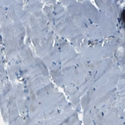 Immunohistochemical staining of human skeletal muscle shows no positivity in myocytes as expected.