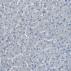 Immunohistochemical staining of human liver shows no positivity in hepatocytes as expected.